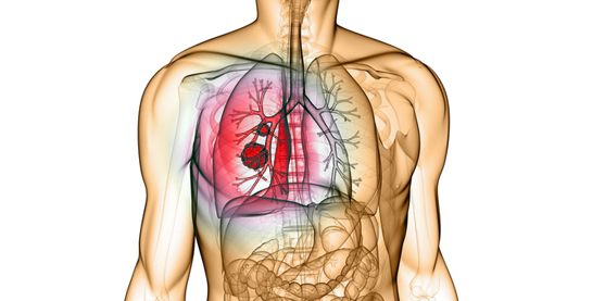 Programa de Reabilitação Pulmonar