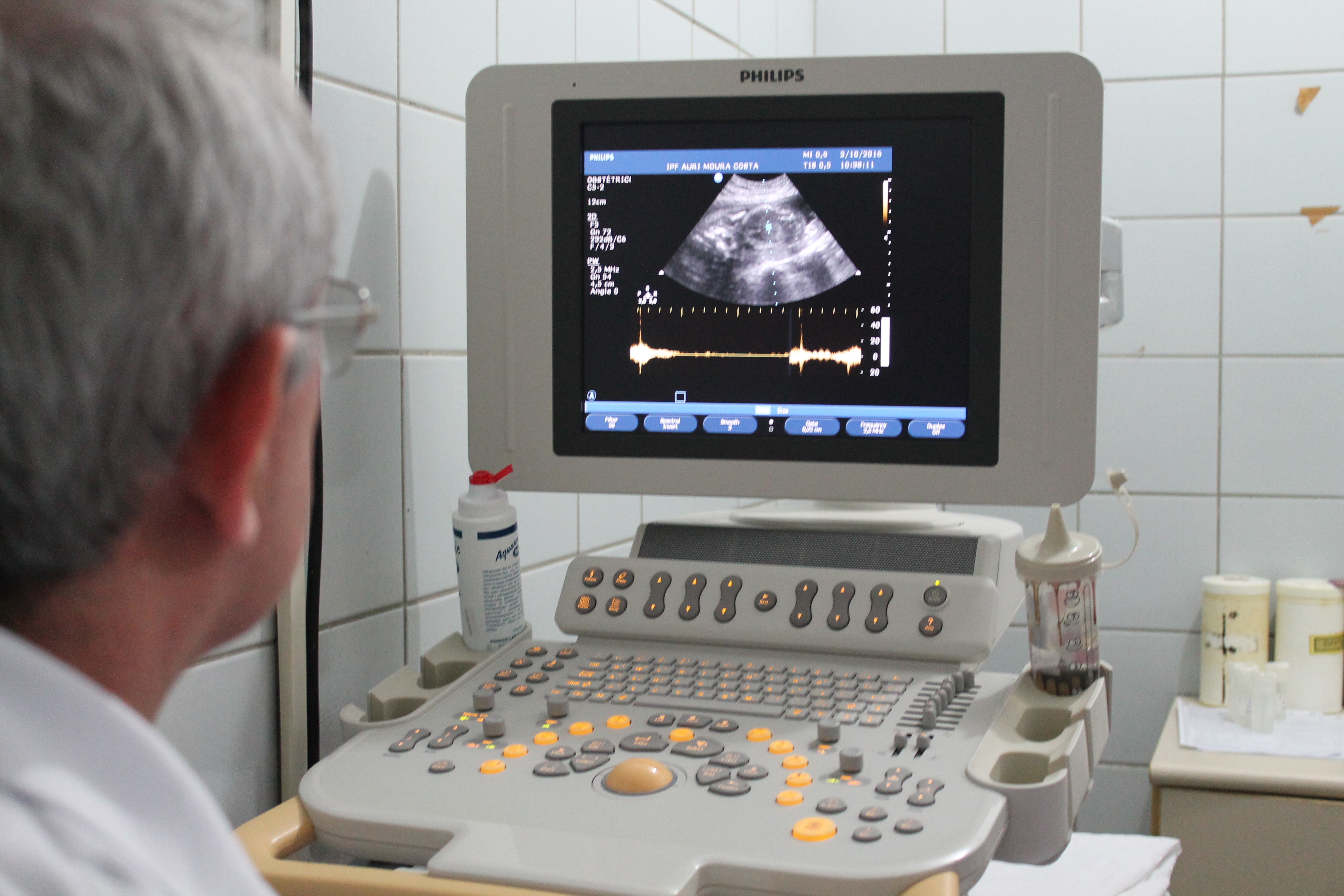Ultrassom melhora atendimento às grávidas do presídio feminino