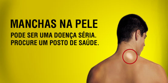 Médicos e enfermeiros do PSF são atualizados em doenças de pele
