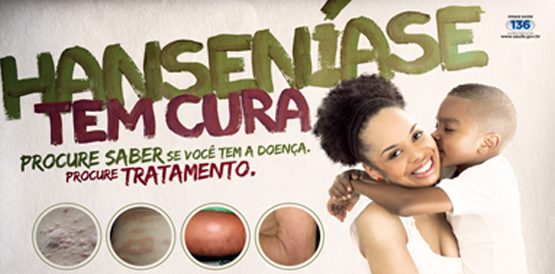 Mobilização na Praça José de Alencar alerta sobre hanseníase