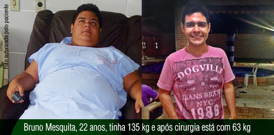 Hospital César Cals faz atendimento integral em cirurgia bariátrica