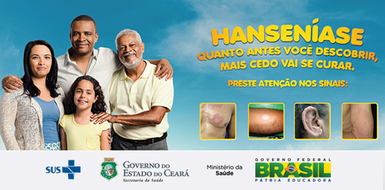 Sesa orienta sobre diagnóstico precoce da hanseníase