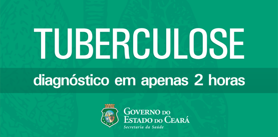 Lacen passa a coordenar teste rápido de tuberculose