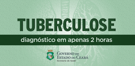 Mais de 5 mil testes rápidos de tuberculose em apenas seis meses