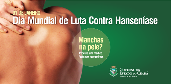 Hanseníase: diagnóstico precoce ajuda no tratamento e evita sequelas
