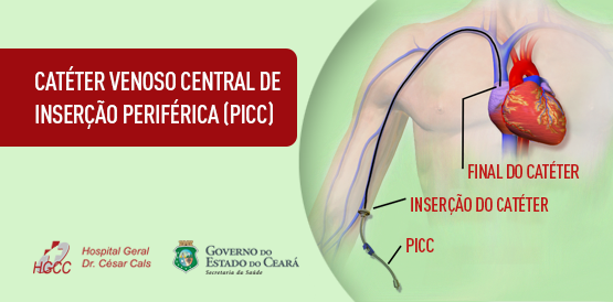 Tecnologia menos invasiva beneficia tratamento de pacientes