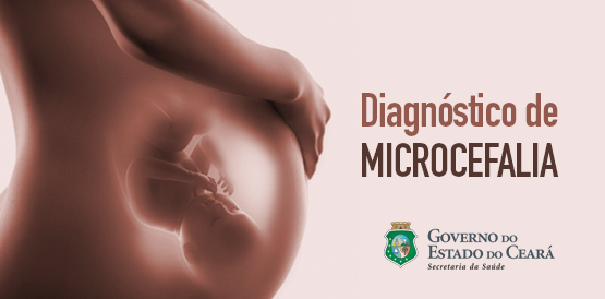 Sesa realiza ação de estratégia rápida para diagnóstico de microcefalia