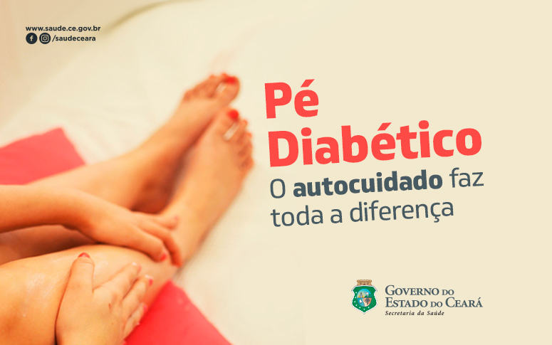 Cuidados simples no dia a dia são fundamentais para evitar pé diabético