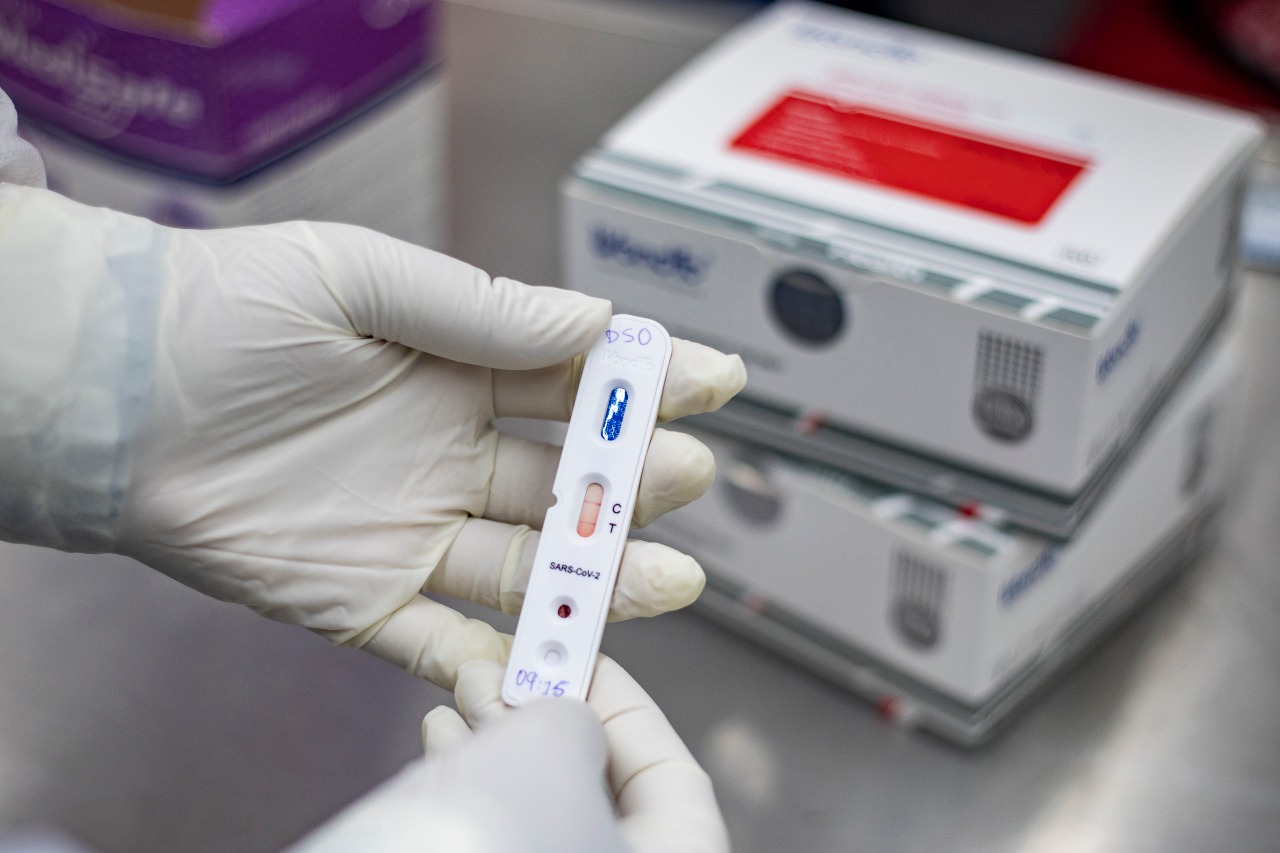 Governo do Ceará distribuirá mais 280 mil testes rápidos na Capital e Interior