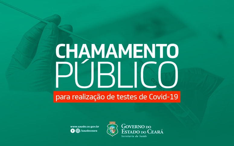 Governo do Ceará lança edital para ampliar realização de exames laboratoriais