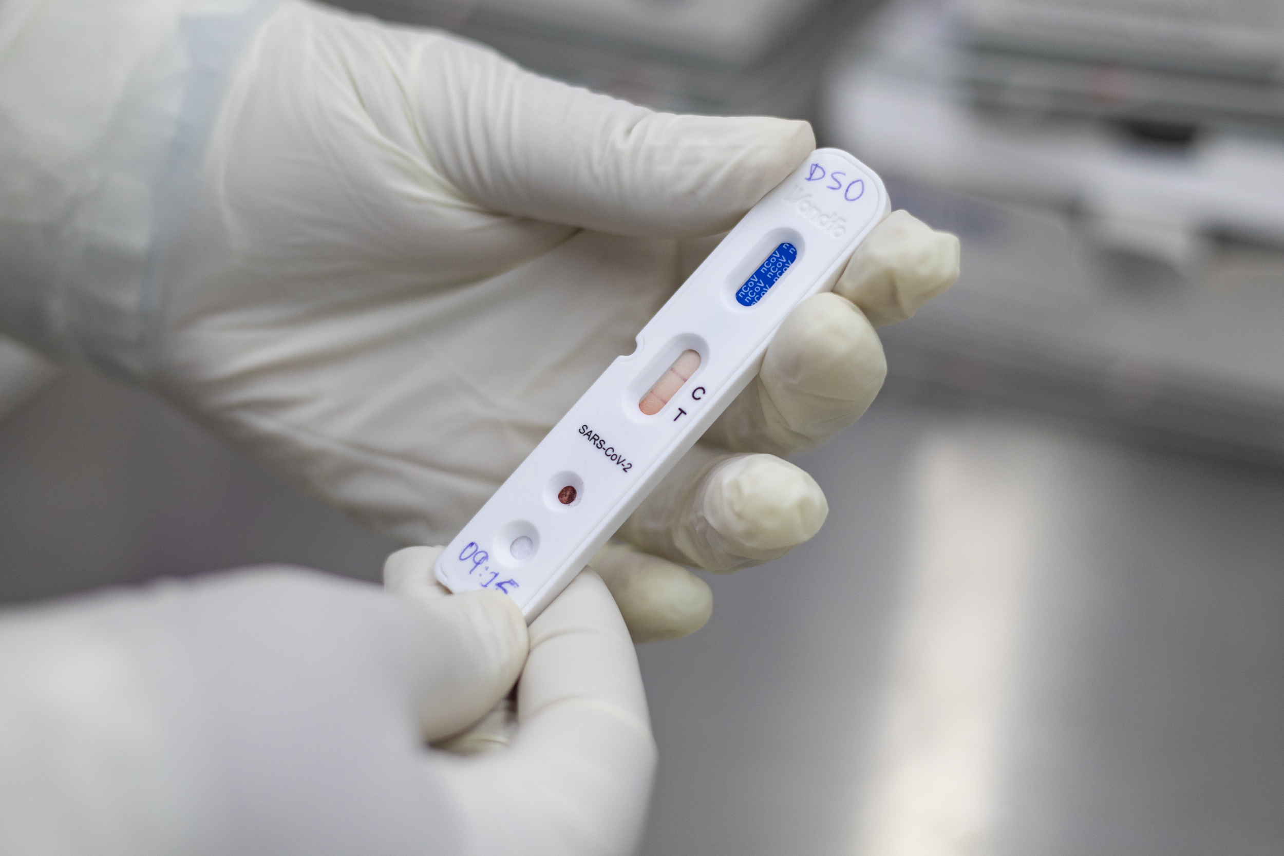 Ceará já distribuiu cerca de 220 mil testes rápidos para municípios