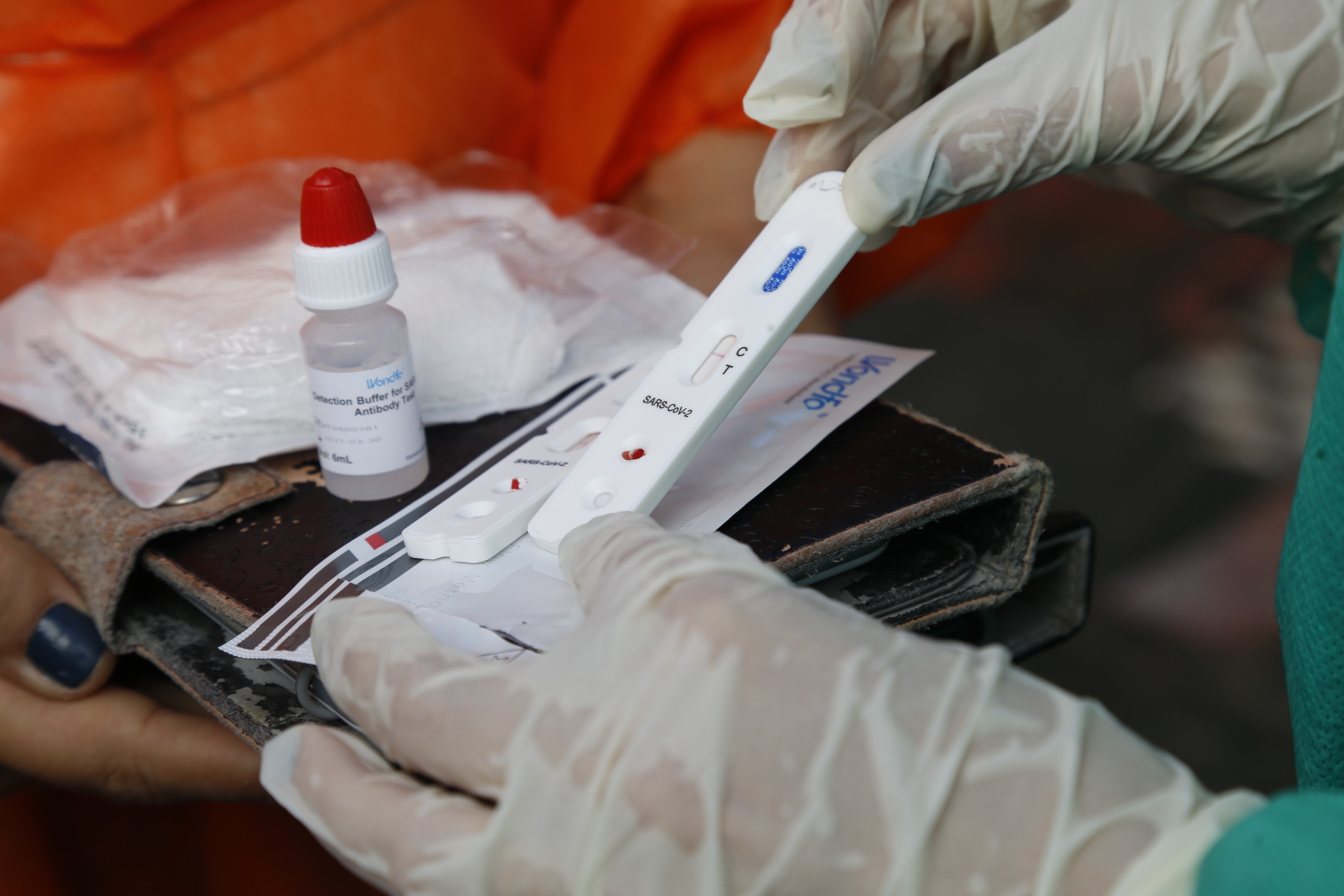 Maior pesquisa epidemiológica do Brasil vai identificar alcance do coronavírus em Fortaleza