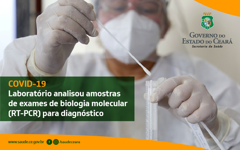 Lacen analisou 100 mil exames para diagnóstico da Covid-19 em seis meses