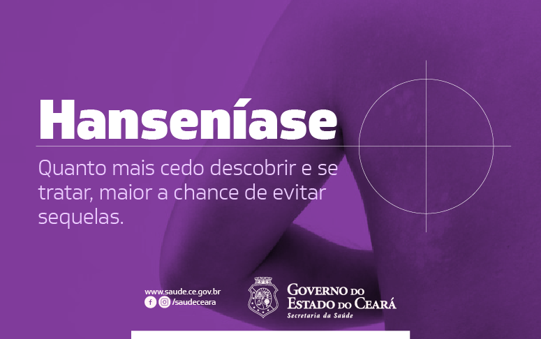 Entrevista: especialista da Sesa orienta como conhecer e tratar precocemente a hanseníase