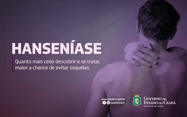 Diagnóstico e tratamento precoce aumentam chances de cura sem sequelas da hanseníase