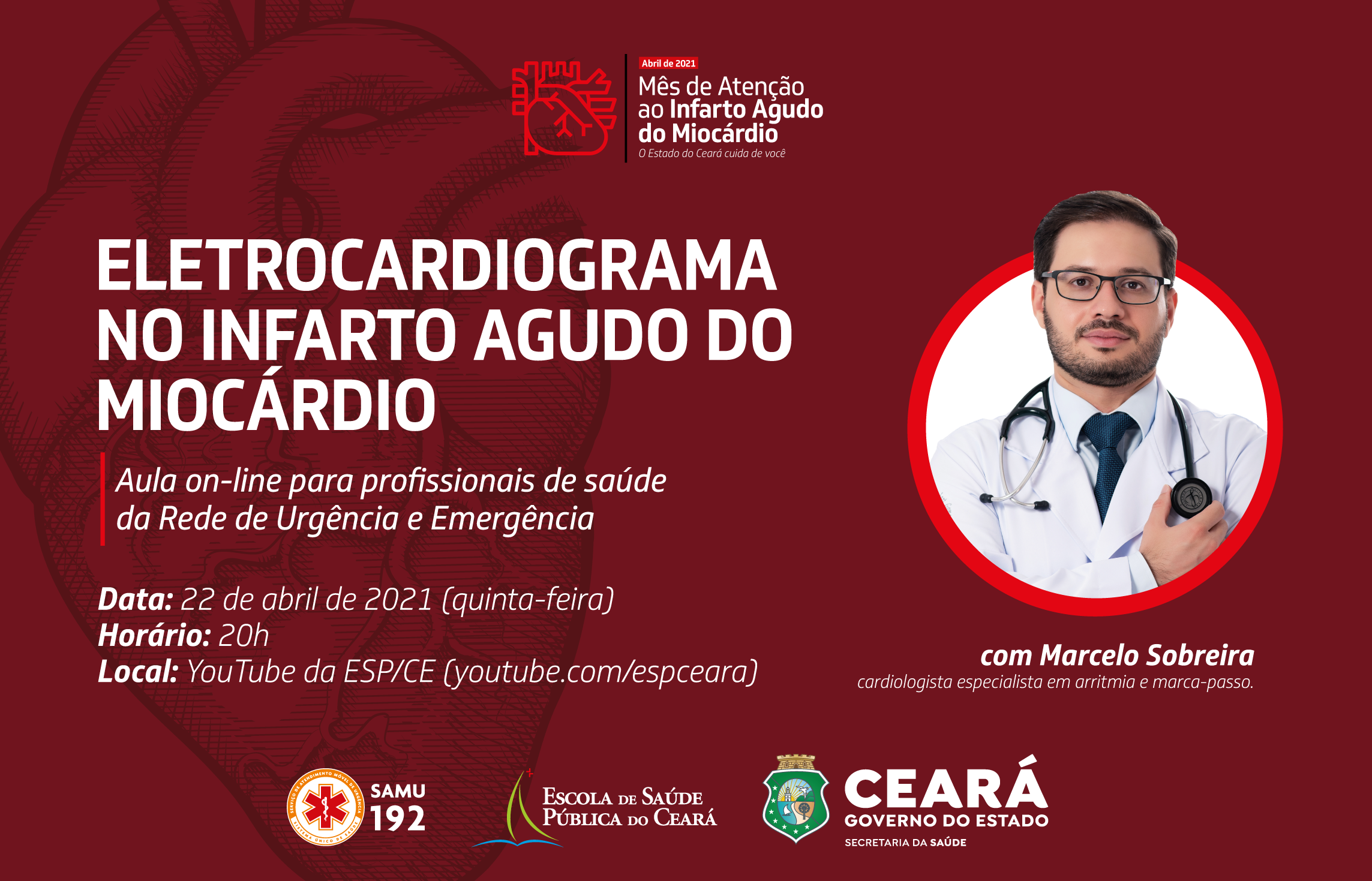Aula on-line para profissionais de saúde aborda o Eletrocardiograma no Infarto Agudo do Miocárdio