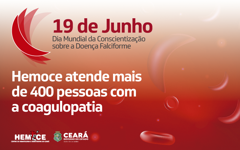 Hemoce oferece assistência a pessoas com doença falciforme e celebra Dia de Conscientização com transmissão ao vivo