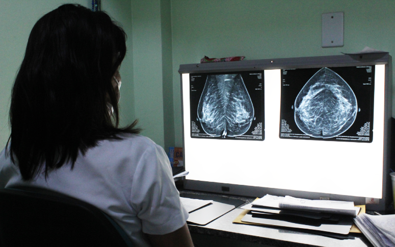 Autoexame pode induzir ao erro: a importância da mamografia no diagnóstico precoce do câncer de mama