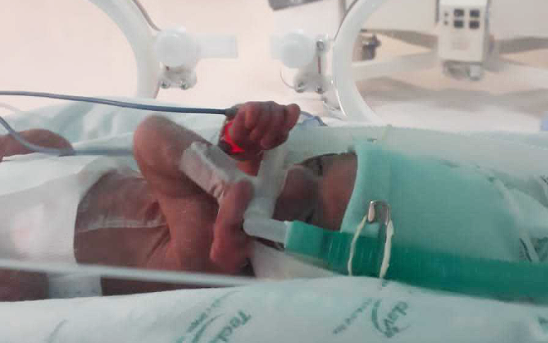 CPAP: tecnologia não-invasiva reduz em mais de 50% intubação de bebês no HRN