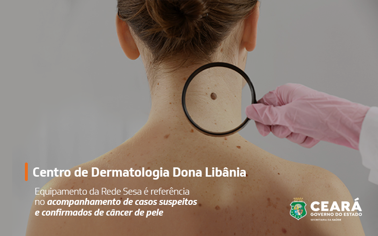 Câncer de pele: especialista detalha sinais de alerta, estimula prevenção e orienta tratamento