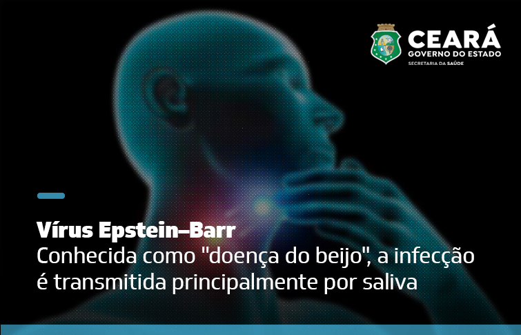 Infectologista do Hospital São José orienta sobre prevenção, diagnóstico e tratamento de mononucleose infecciosa