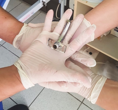Equipe da CCC supera meta de “desmame” de pacientes traqueostomizados; entenda o procedimento