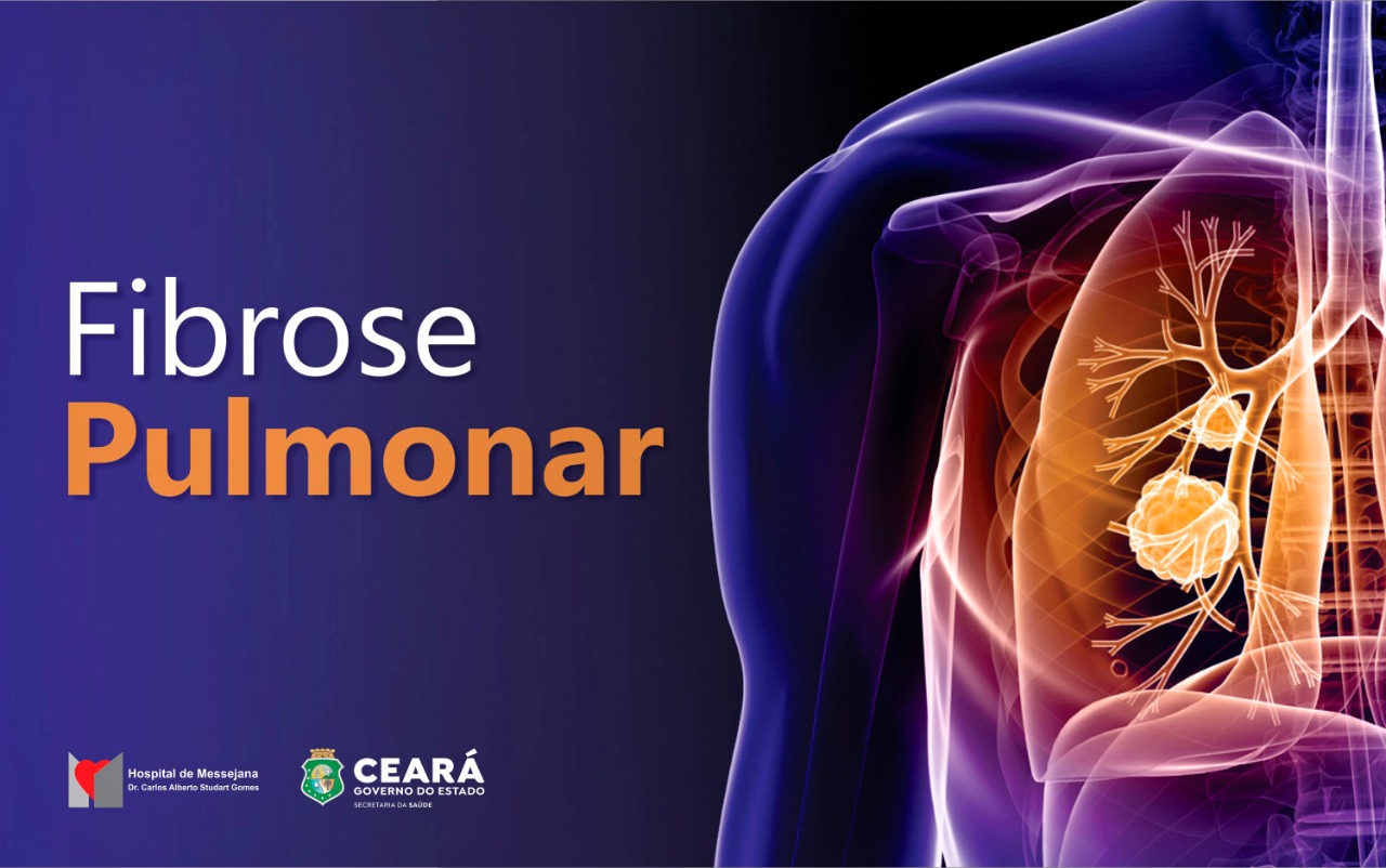 Pneumologista do HM detalha sintomas e tratamento da fibrose pulmonar, causa da morte da cantora cearense Rita de Cássia