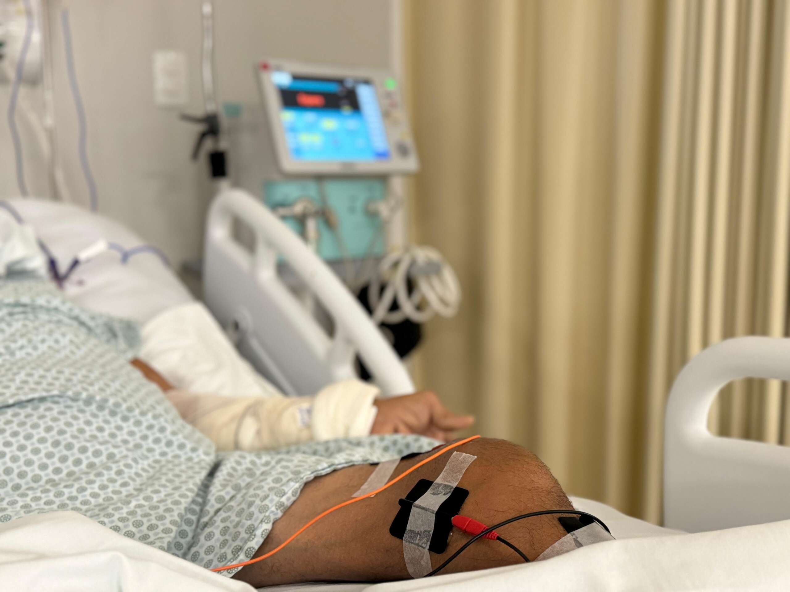 Eletroestimulação evita perda muscular de pacientes internados com dificuldades de mobilização