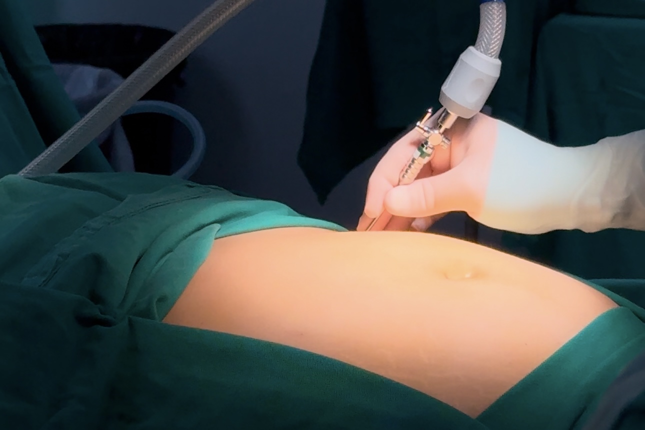 HGF dá início ao Programa de Cirurgia Bariátrica e inaugura Salas Inteligentes