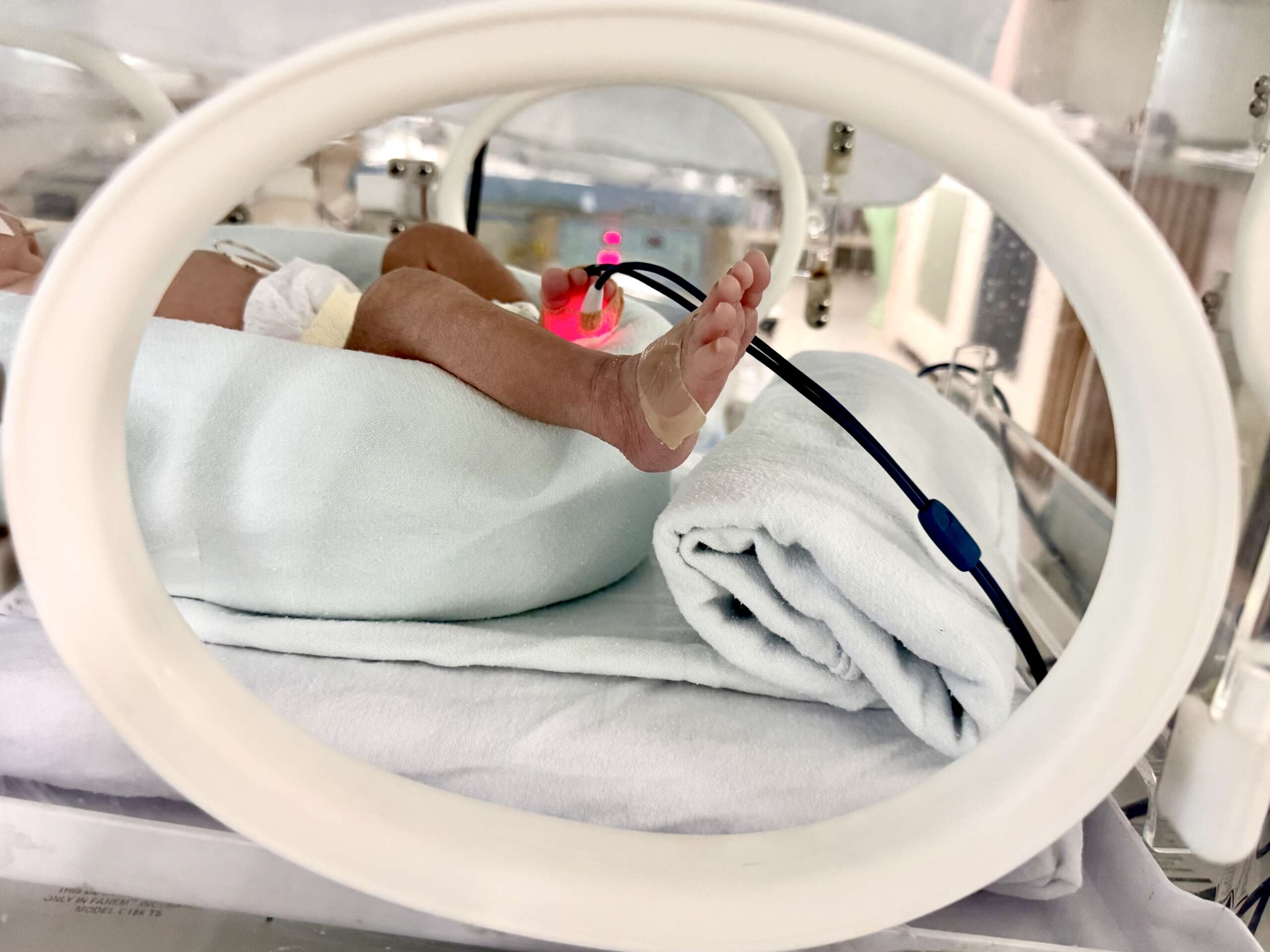 Hospital Geral Dr. Waldemar Alcântara reforça pedido por doação de leite humano durante Agosto Dourado