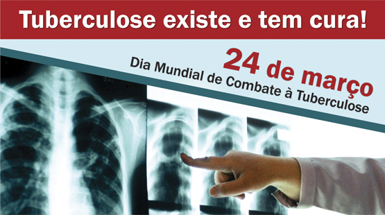 Hospital de Messejana é referência estadual no tratamento da Tuberculose Multirresistente