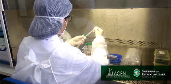 Laboratório Central de Saúde Pública realiza mais de um milhão de exames