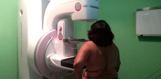 Mamografia é principal exame que detecta sinais precoces de câncer de mama