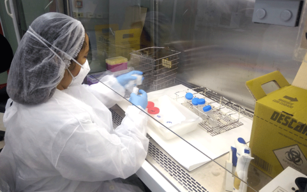 Ceará amplia serviço de teste rápido de tuberculose