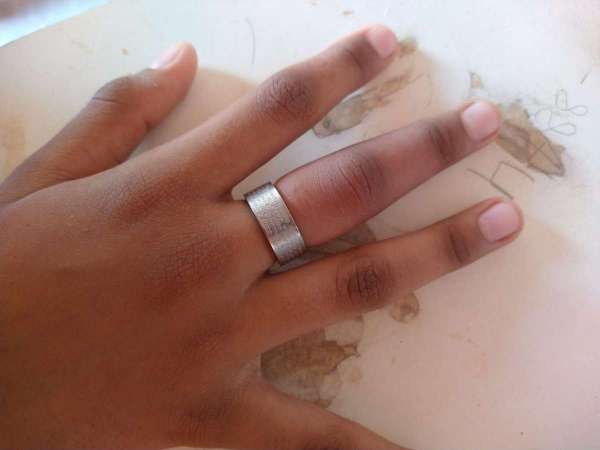 Corpo de Bombeiros retira anel preso em dedo de criança em Caucaia