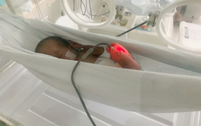 Com ofurô e mini redes, exercícios sensoriais contribuem para a evolução de bebês no HGWA