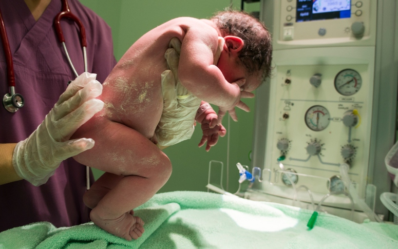 Primeiros minutos de vida: Escala de Apgar auxilia na assistência neonatal