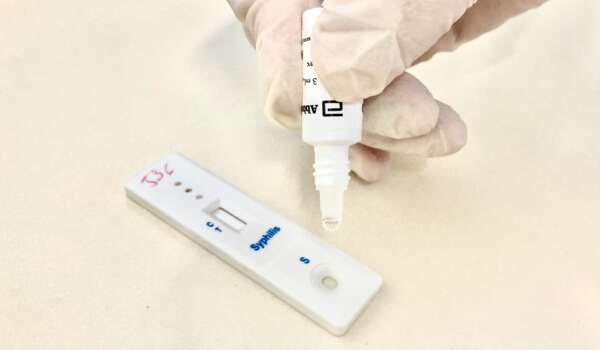 Sesa realiza webinar com foco em controle de sífilis congênita