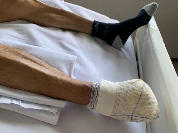 Diabetes: procurar especialista é fundamental para evitar danos mais graves causados pela doença