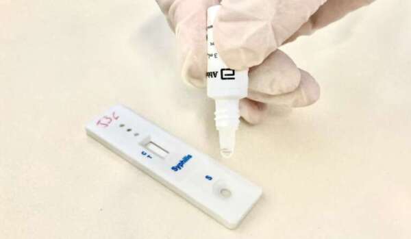 Dois municípios cearenses recebem Selo Prata rumo à eliminação da transmissão vertical de HIV e de sífilis