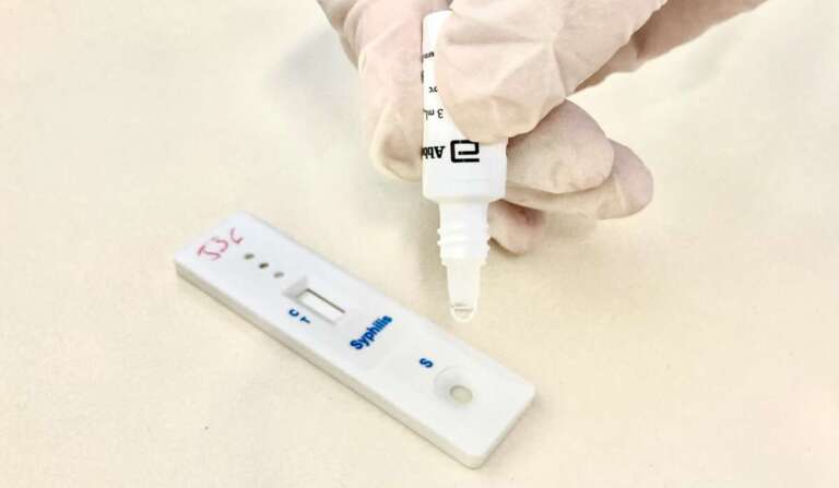 Dois municípios cearenses recebem Selo Prata rumo à eliminação da transmissão vertical de HIV e de sífilis