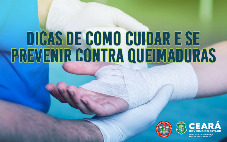 Dia Nacional de Luta Contra Queimaduras: SSPDS destaca orientações de profissionais para vítimas dessas ocorrências