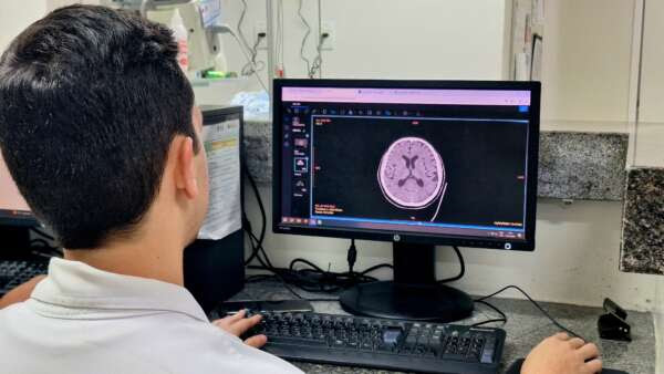 Saiba hábitos que podem afetar a saúde do cérebro; HRC orienta sobre prevenção de doenças neurológicas