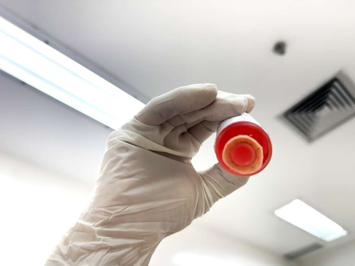 Serviço de Verificação de Óbitos do Ceará realiza as primeiras captações de córneas em parceria com Hospital Geral de Fortaleza