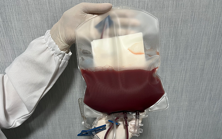 Hemoce realiza pela primeira vez coleta simultânea de medula óssea de voluntários do Redome