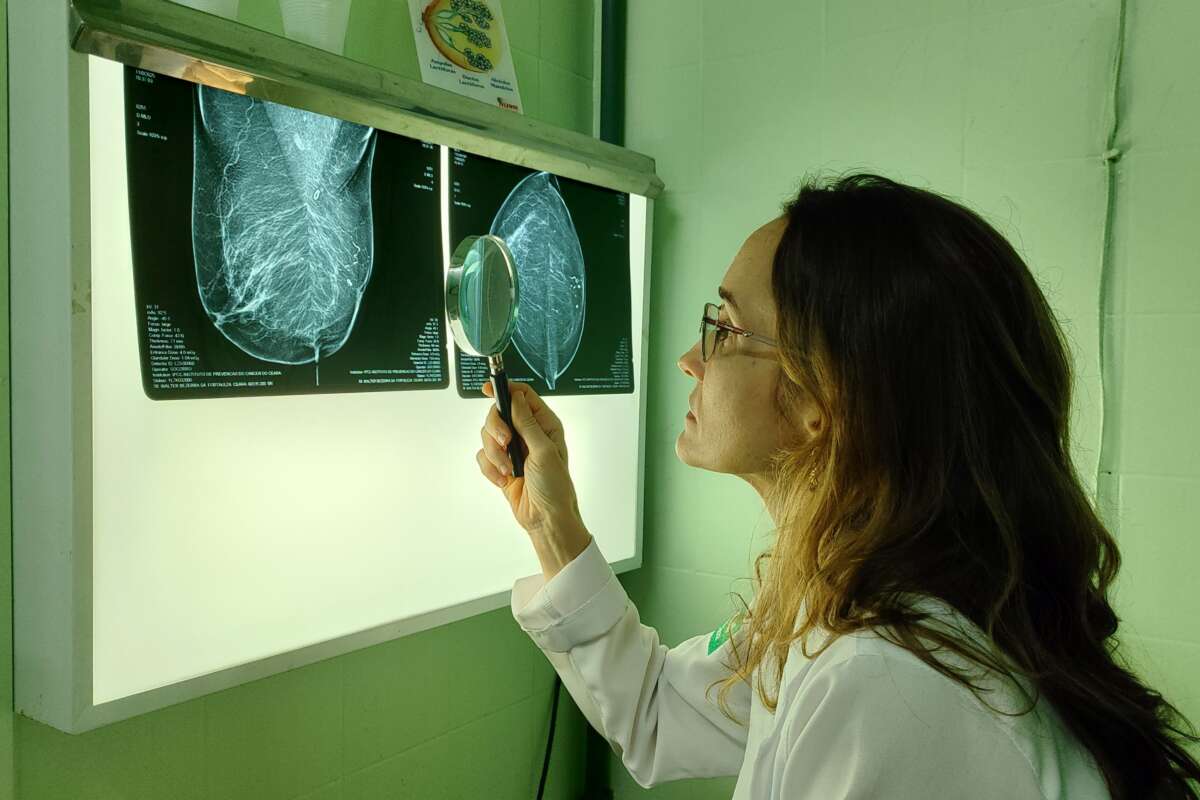 Saúde Ceará incrementa número de mamografias realizadas e amplia chances de diagnóstico precoce de câncer de mama