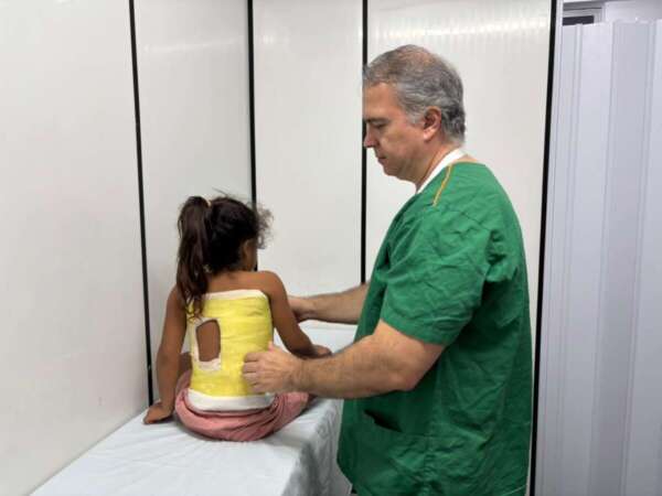 Hospital Infantil Albert Sabin aplica técnica inovadora que utiliza gesso para tratar crianças com escoliose precoce